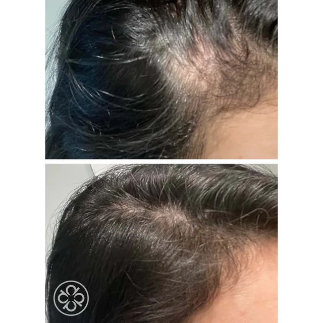 Hair Energize Extra-Strength Overnight Serum