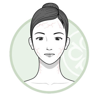 sensitive skin icon